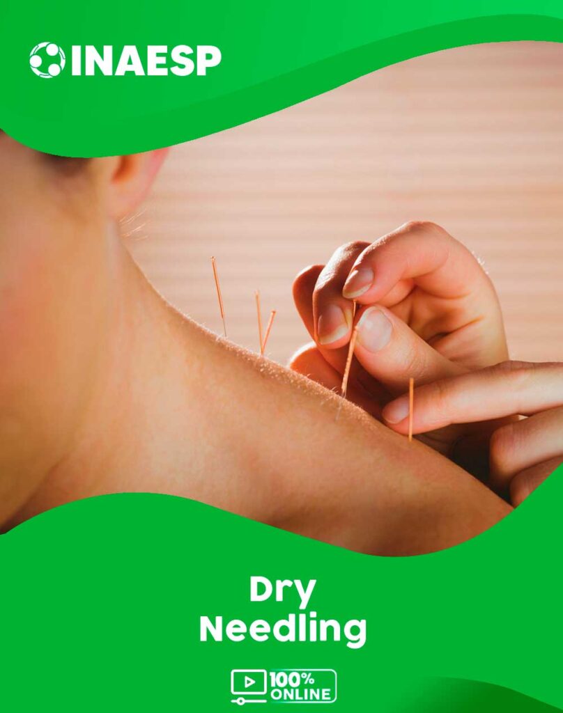 Curso Dry Needling – Instituto Nacional De Ensino, Pesquisa E Saúde ...