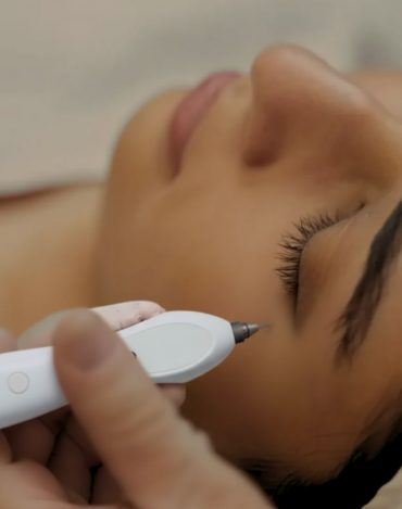 Curso Master em Jato de Plasma