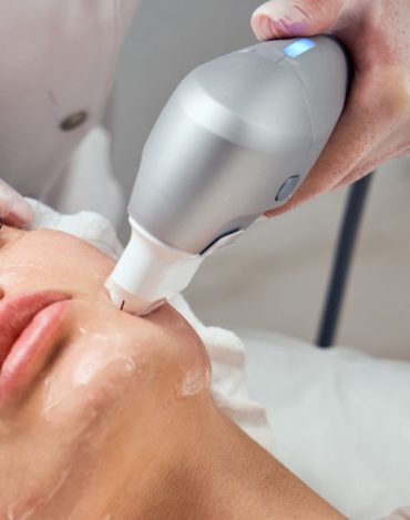 Curso de Ultraformer MPT