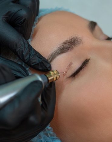 Curso de Blefaroplastia Sem Cortes